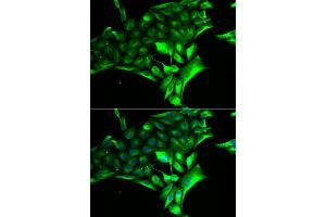 Immunofluorescence analysis of MCF-7 cell using PYGB antibody.