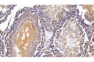 Detection of HIF1a in Rat Testis Tissue using Polyclonal Antibody to Hypoxia Inducible Factor 1 Alpha (HIF1a)