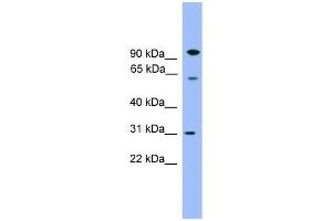 Western Blot showing CPNE6 antibody used at a concentration of 1-2 ug/ml to detect its target protein. (CPNE6 anticorps  (Middle Region))