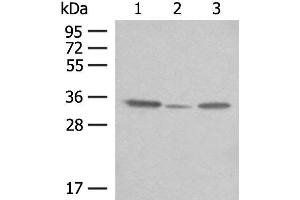 Western blot analysis of OP9 HepG2 and NIH/3T3 cell lysates using CNPY3 Polyclonal Antibody at dilution of 1:400 (TNRC5 anticorps)