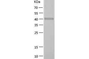 Western Blotting (WB) image for Diacylglycerol Kinase, eta (DGKH) (AA 1-187) protein (His-IF2DI Tag) (ABIN7122652)