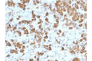 Immunohistochemical staining (Formalin-fixed paraffin-embedded sections) of human pituitary gland with GH1 monoclonal antibody, clone GH/1371 . (Growth Hormone 1 anticorps  (AA 58-187))