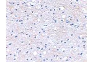 Immunohistochemical staining of human brain tissue using HAPLN2 polyclonal antibody  at 2. (HAPLN2 anticorps  (Internal Region))