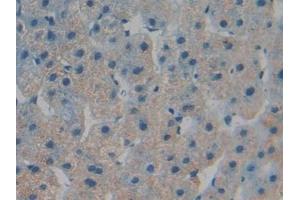 Detection of TOR1B in Human Liver Tissue using Polyclonal Antibody to Torsin 1B (TOR1B)