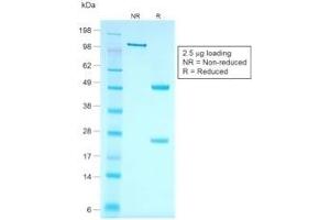SDS-PAGE Analysis Purified CK7 Recombinant Mouse Monoclonal Antibody (rOV-TL12/30).
