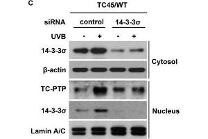 AKT cooperates with 14-3-3σ to facilitate nuclear translocation of TC45 in response to UVB irradiationWestern blot analysis of A.