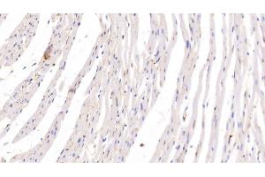 Detection of ADPN in Rat Heart Tissue using Monoclonal Antibody to Adiponectin (ADPN) (ADIPOQ anticorps  (AA 111-244))