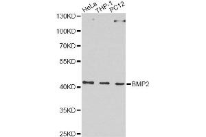 Western blot analysis of extracts of various cell lines, using BMP2 Antibody. (BMP2 anticorps  (AA 283-396))