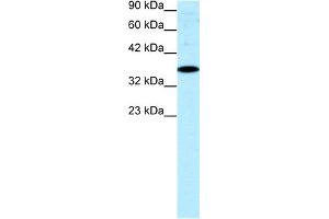 WB Suggested Anti-NR4A1 Antibody Titration:  0. (NR4A1 anticorps  (N-Term))