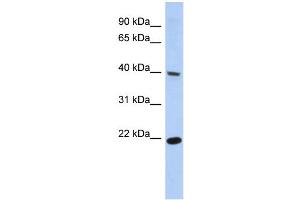 WB Suggested Anti-SSBP4 Antibody Titration:  0. (SSBP4 anticorps  (Middle Region))