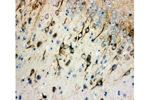 IHC-P: AChR antibody testing of rat brain tissue (CHRM1 anticorps  (AA 303-317))