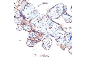 Immunohistochemistry of paraffin-embedded human placenta using ER Rabbit mAb (ABIN7266941) at dilution of 1:100 (40x lens).