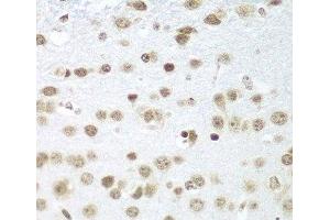 Immunohistochemistry of paraffin-embedded Mouse brain using SAP18 Polyclonal Antibody at dilution of 1:100 (40x lens). (SAP18 anticorps)