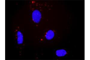 Proximity Ligation Analysis of protein-protein interactions between PTPRR and MAPK1.