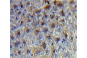 Used in DAB staining on fromalin fixed paraffin-embedded Liver tissue (CEBPG anticorps  (AA 1-150))