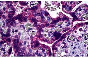 Human Placenta: Formalin-Fixed, Paraffin-Embedded (FFPE) (S1PR3 anticorps)