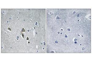 Immunohistochemistry (IHC) image for anti-Ornithine Decarboxylase Antizyme 1 (OAZ1) (N-Term) antibody (ABIN1851761) (OAZ1 anticorps  (N-Term))
