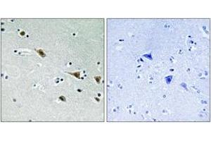 Immunohistochemistry analysis of paraffin-embedded human brain, using MAP2K7 (Phospho-Ser271) Antibody.