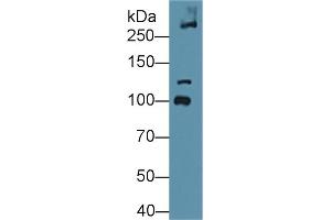 Detection of COL6a3 in Mouse Bladder lysate using Polyclonal Antibody to Collagen Type VI Alpha 3 (COL6a3) (COL6a3 anticorps  (AA 2009-2205))