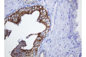 anti-Src-like-adaptor 2 (SLA2) antibody