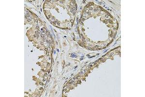 Immunohistochemistry of paraffin-embedded human prostate using CCNA2 antibody. (Cyclin A anticorps  (AA 1-200))