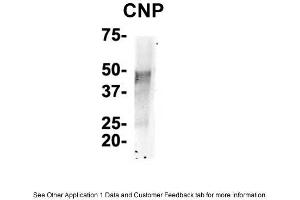 IP Suggested Anti-CNP Antibody    Positive Control:  NT2 CELL/BRAIN TISSUE (Cnpase anticorps  (N-Term))