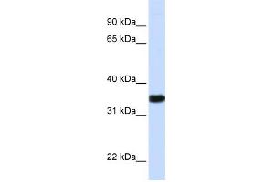 WB Suggested Anti-GAPDH Antibody Titration:  0. (GAPDH anticorps  (N-Term))