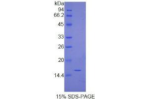 SDS-PAGE analysis of Human Immunoglobulin G4 Protein. (IgG4 Protéine)