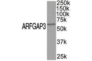 Western Blotting (WB) image for anti-ADP-Ribosylation Factor GTPase Activating Protein 3 (ARFGAP3) antibody (ABIN2477490) (ARFGAP3 anticorps)