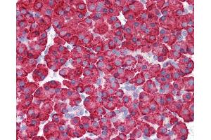 Anti-MDA5 antibody IHC of human pancreas. (IFIH1 anticorps  (C-Term))