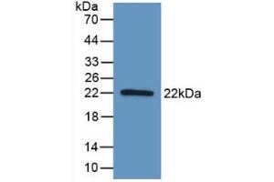 Detection of Recombinant AATK, Human using Polyclonal Antibody to Apoptosis Associated Tyrosine Kinase (AATK) (AATK anticorps  (AA 1216-1374))