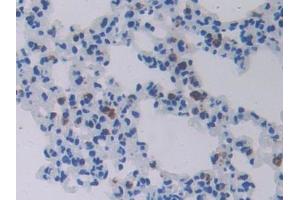 IHC-P analysis of Mouse Lung Tissue, with DAB staining. (CHI3L1 anticorps  (AA 112-356))