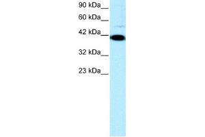 WB Suggested Anti-ZFP1 Antibody Titration: 0. (Zfp-1 anticorps  (N-Term))