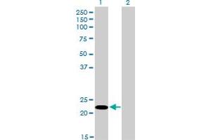 Western Blotting (WB) image for anti-serine/arginine-Rich Splicing Factor 10 (SRSF10) (AA 1-101) antibody (ABIN599153) (SRSF10 anticorps  (AA 1-101))