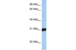 B3GALT6 antibody used at 1 ug/ml to detect target protein. (B3GALT6 anticorps  (C-Term))
