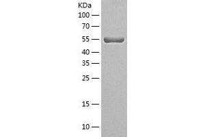 Western Blotting (WB) image for Syntrophin, alpha 1 (Dystrophin-Associated Protein A1, 59kDa, Acidic Component) (SNTA1) (AA 1-505) protein (His-IF2DI Tag) (ABIN7125297)