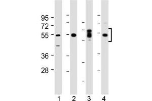 Western blot testing of human 1) kidney, 2) lung, 3) placenta and 4) HeLa lysate with SGK1 antibody at 1:2000.
