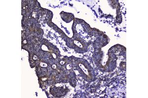 IHC analysis of COX IV using anti-COX IV antibody .