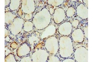 Immunohistochemistry of paraffin-embedded human thyroid tissue using ABIN7151410 at dilution of 1:100 (KIAA0494 anticorps  (AA 1-483))