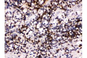 Anti- CD22 Picoband antibody, IHC(P) IHC(P): Human Tonsil Tissue (CD22 anticorps  (C-Term))