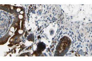 ABIN6269178 at 1/100 staining Mouse intestine tissue by IHC-P. (GABA-RB anticorps)