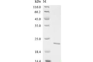 (Tris-Glycine gel) Discontinuous SDS-PAGE (reduced) with 5 % enrichment gel and 15 % separation gel.