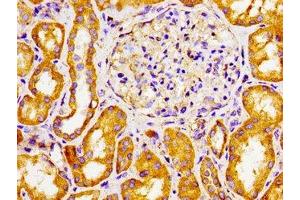 Immunohistochemistry of paraffin-embedded human kidney tissue using ABIN7170770 at dilution of 1:100 (CYP27A1 anticorps  (AA 290-407))