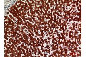 Immunohistochemistry (IHC) analysis of paraffin-embedded Human Liver, antibody was diluted at 1:100.