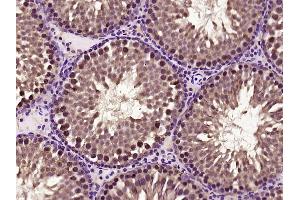 Paraformaldehyde-fixed, paraffin embedded rat testis; Antigen retrieval by boiling in sodium citrate buffer (pH6) for 15min; Block endogenous peroxidase by 3% hydrogen peroxide for 30 minutes; Blocking buffer (normal goat serum) at 37°C for 20min; Antibody incubation with C1orf200 Polyclonal Antibody, Unconjugated (bs-15055R) at 1:400 overnight at 4°C, followed by a conjugated secondary and DAB staining. (C1orf200 anticorps  (AA 31-100))