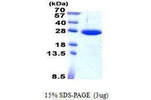 Figure annotation denotes ug of protein loaded and % gel used. (SAR1B Protéine)