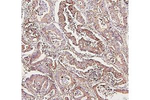 IHC analysis of ALDOA using anti-ALDOA antibody (ABIN7601907). (ALDOA anticorps  (AA 50-364))