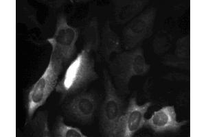 Cyclin B1 staining of U-2 OS (ATCC HTB-96) cells.