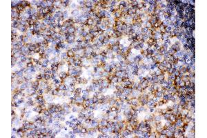 Anti- Lck Picoband antibody, IHC(P) IHC(P): Human Tonsil Tissue
