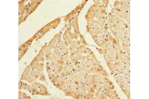 Immunohistochemistry of paraffin-embedded human heart tissue using ABIN7158825 at dilution of 1:100